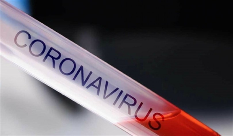 Coronavirus: 27.317 pazienti guariti, 4.153 decessi, 34.040 contagi